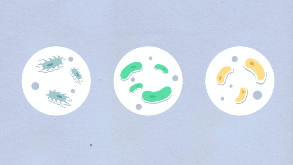 Giardiasis infection
